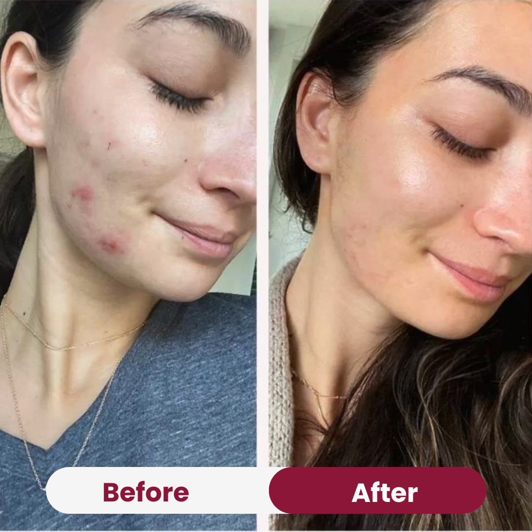 Zero Pore Pad
