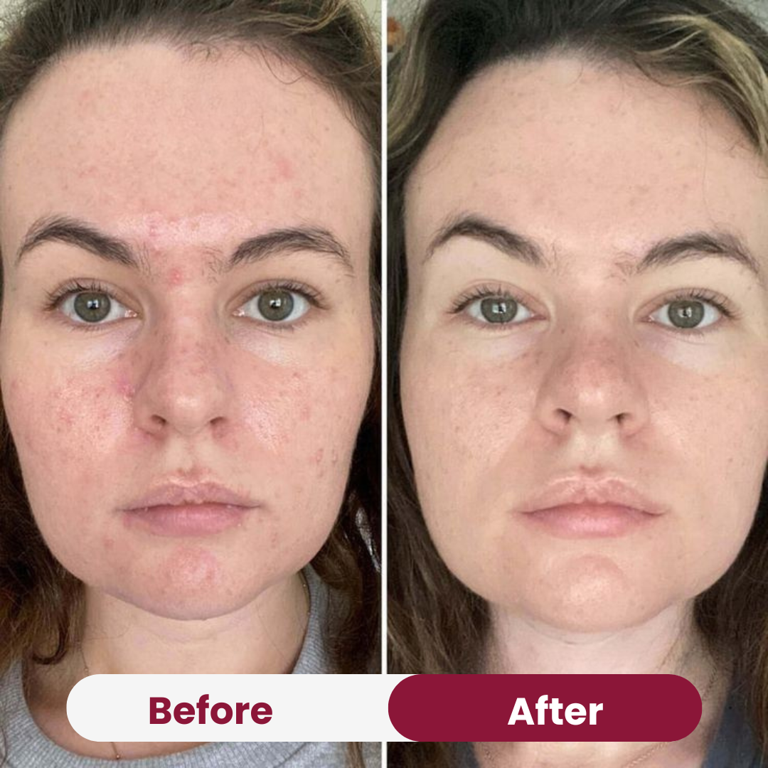 Zero Pore Pad