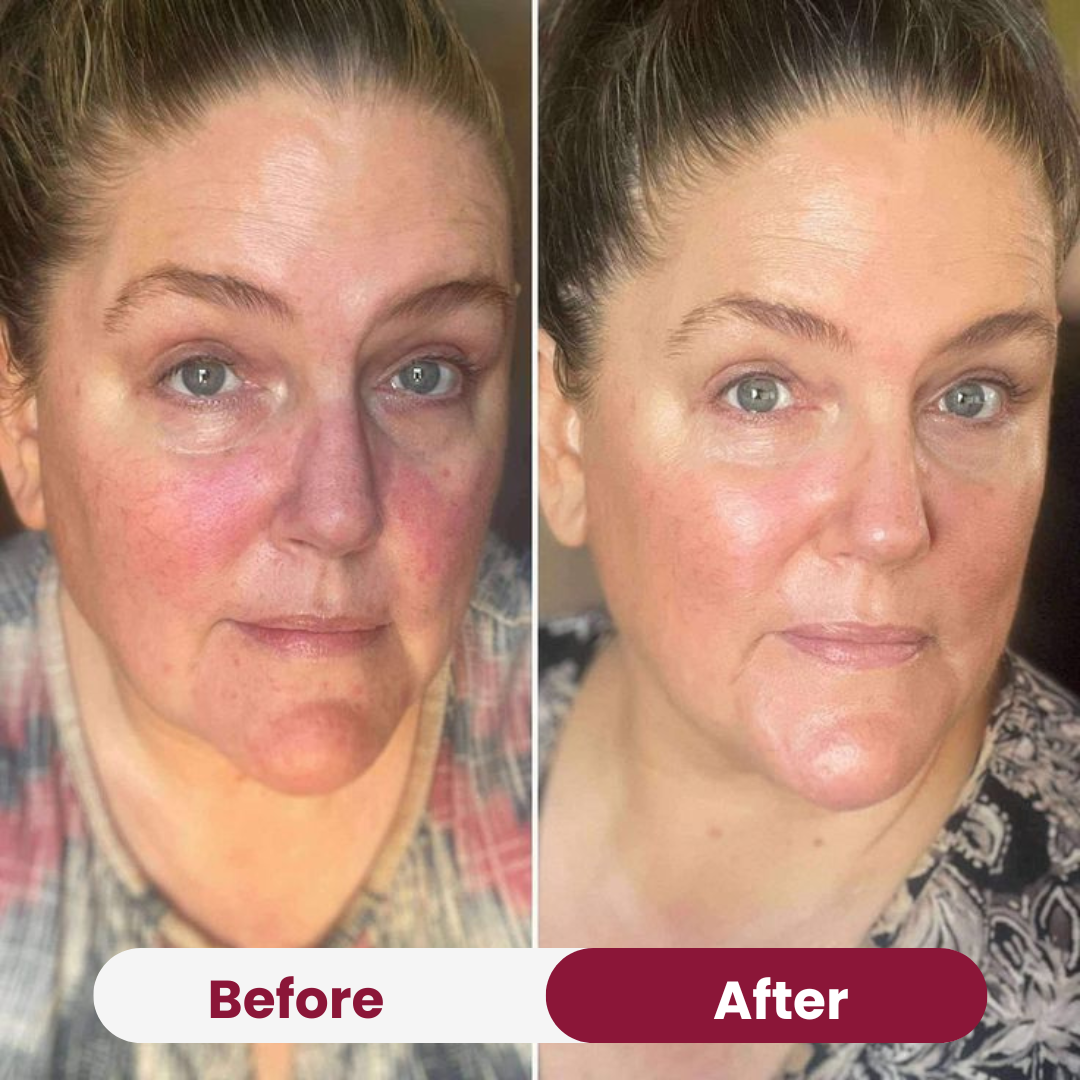 Glow Therapy Duo